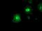 Farnesyl-Diphosphate Farnesyltransferase 1 antibody, MA5-25675, Invitrogen Antibodies, Immunocytochemistry image 