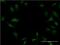 Twist-related protein 2 antibody, H00117581-M06, Novus Biologicals, Immunocytochemistry image 