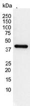 Actin Gamma 2, Smooth Muscle antibody, MCA5776GA, Bio-Rad (formerly AbD Serotec) , Immunofluorescence image 