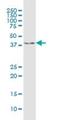 Rho Guanine Nucleotide Exchange Factor 39 antibody, H00084904-B02P, Novus Biologicals, Western Blot image 