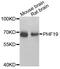 PHD Finger Protein 19 antibody, STJ110368, St John