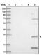 Hydroxysteroid 17-Beta Dehydrogenase 13 antibody, NBP1-90669, Novus Biologicals, Immunohistochemistry frozen image 
