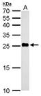 NADH:Ubiquinone Oxidoreductase Core Subunit V2 antibody, LS-C185478, Lifespan Biosciences, Western Blot image 