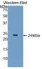 Interleukin 1 Receptor Antagonist antibody, LS-C301551, Lifespan Biosciences, Western Blot image 