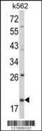Killer Cell Lectin Like Receptor D1 antibody, 63-557, ProSci, Western Blot image 