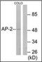 Transcription Factor AP-2 Alpha antibody, orb96478, Biorbyt, Western Blot image 
