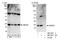 Ubiquitin Conjugating Enzyme E2 E2 antibody, NBP1-80573, Novus Biologicals, Western Blot image 