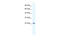 Potassium Channel Tetramerization Domain Containing 11 antibody, 28-565, ProSci, Enzyme Linked Immunosorbent Assay image 