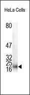p21 antibody, 252156, Abbiotec, Western Blot image 