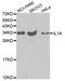 Interleukin 1 Alpha antibody, A2170, ABclonal Technology, Western Blot image 