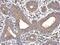 ATPase Sarcoplasmic/Endoplasmic Reticulum Ca2+ Transporting 3 antibody, NBP2-20306, Novus Biologicals, Immunohistochemistry paraffin image 
