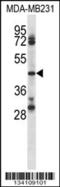 CD84 Molecule antibody, 57-768, ProSci, Western Blot image 
