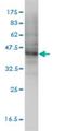 Molybdenum Cofactor Synthesis 3 antibody, H00027304-M01, Novus Biologicals, Western Blot image 