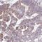 Phosphatidylinositol Glycan Anchor Biosynthesis Class K antibody, HPA057040, Atlas Antibodies, Immunohistochemistry frozen image 