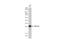 Heparin Binding EGF Like Growth Factor antibody, GTX02860, GeneTex, Western Blot image 