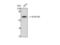 Aldehyde Dehydrogenase 1 Family Member B1 antibody, STJ91554, St John