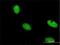 Zinc Finger Protein 274 antibody, H00010782-M04, Novus Biologicals, Immunocytochemistry image 