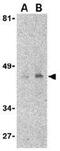 CD209 Molecule antibody, GTX84993, GeneTex, Western Blot image 