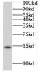 Ribonuclease UK114 antibody, FNab04014, FineTest, Western Blot image 