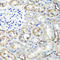 TNF Alpha Induced Protein 6 antibody, A03433-2, Boster Biological Technology, Immunohistochemistry paraffin image 