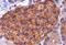 IQ Motif Containing GTPase Activating Protein 1 antibody, ab86064, Abcam, Immunohistochemistry paraffin image 