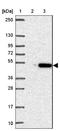 Purinergic Receptor P2X 3 antibody, NBP2-33848, Novus Biologicals, Western Blot image 
