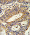 Interleukin 17 Receptor B antibody, LS-C165179, Lifespan Biosciences, Immunohistochemistry paraffin image 