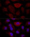 Ribosomal Protein L21 antibody, 15-452, ProSci, Immunofluorescence image 
