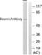 Desmin antibody, LS-C118429, Lifespan Biosciences, Western Blot image 