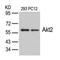 AKT Serine/Threonine Kinase 2 antibody, GTX50494, GeneTex, Western Blot image 