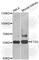ETS Proto-Oncogene 2, Transcription Factor antibody, A3855, ABclonal Technology, Western Blot image 