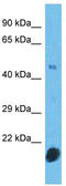 Cyclin N-Terminal Domain Containing 2 antibody, TA335458, Origene, Western Blot image 