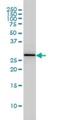 Proteasome Activator Subunit 2 antibody, H00005721-M02, Novus Biologicals, Western Blot image 