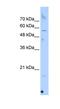 Selenoprotein N antibody, NBP1-79248, Novus Biologicals, Western Blot image 