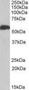 Aldehyde Dehydrogenase 5 Family Member A1 antibody, TA311586, Origene, Western Blot image 