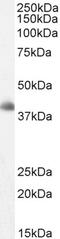 Dickkopf WNT Signaling Pathway Inhibitor 3 antibody, 45-485, ProSci, Enzyme Linked Immunosorbent Assay image 