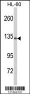 Complement C5 antibody, 63-525, ProSci, Western Blot image 