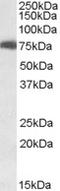 USH1 Protein Network Component Harmonin antibody, LS-C55649, Lifespan Biosciences, Western Blot image 