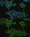 Interferon Regulatory Factor 3 antibody, GTX54366, GeneTex, Immunocytochemistry image 