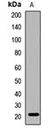 Crystallin Gamma C antibody, LS-C667808, Lifespan Biosciences, Western Blot image 