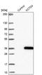 Potassium Channel Tetramerization Domain Containing 4 antibody, PA5-59272, Invitrogen Antibodies, Western Blot image 