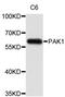 P21 (RAC1) Activated Kinase 1 antibody, abx126996, Abbexa, Western Blot image 