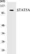 Signal Transducer And Activator Of Transcription 5A antibody, EKC1545, Boster Biological Technology, Western Blot image 