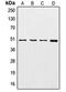 Tubulin Gamma 1 antibody, orb214704, Biorbyt, Western Blot image 