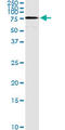 Acyl-CoA Synthetase Long Chain Family Member 5 antibody, LS-C133760, Lifespan Biosciences, Immunoprecipitation image 