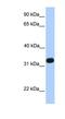 Acrosomal Vesicle Protein 1 antibody, NBP1-79534, Novus Biologicals, Western Blot image 