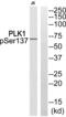 Polo Like Kinase 1 antibody, PA5-39752, Invitrogen Antibodies, Western Blot image 