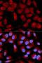 Pyruvate Dehydrogenase E1 Alpha 1 Subunit antibody, LS-C331751, Lifespan Biosciences, Immunofluorescence image 