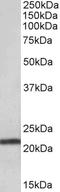 Transmembrane Protein 205 antibody, EB10488, Everest Biotech, Western Blot image 