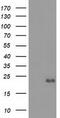 Ephrin A2 antibody, M09844, Boster Biological Technology, Western Blot image 